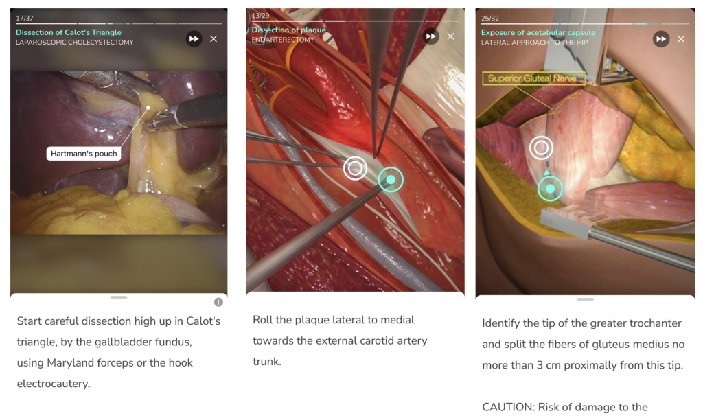 Touch Surgery for Medical School Surgery Rotation